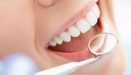 Как ухаживать за зубами после имплантации